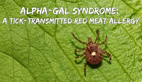 The Growing Tick Endemic in the United States: